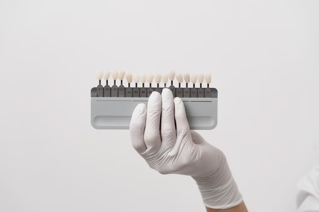 How Dental Implants Preserve Jawbone Health and Facial Structure