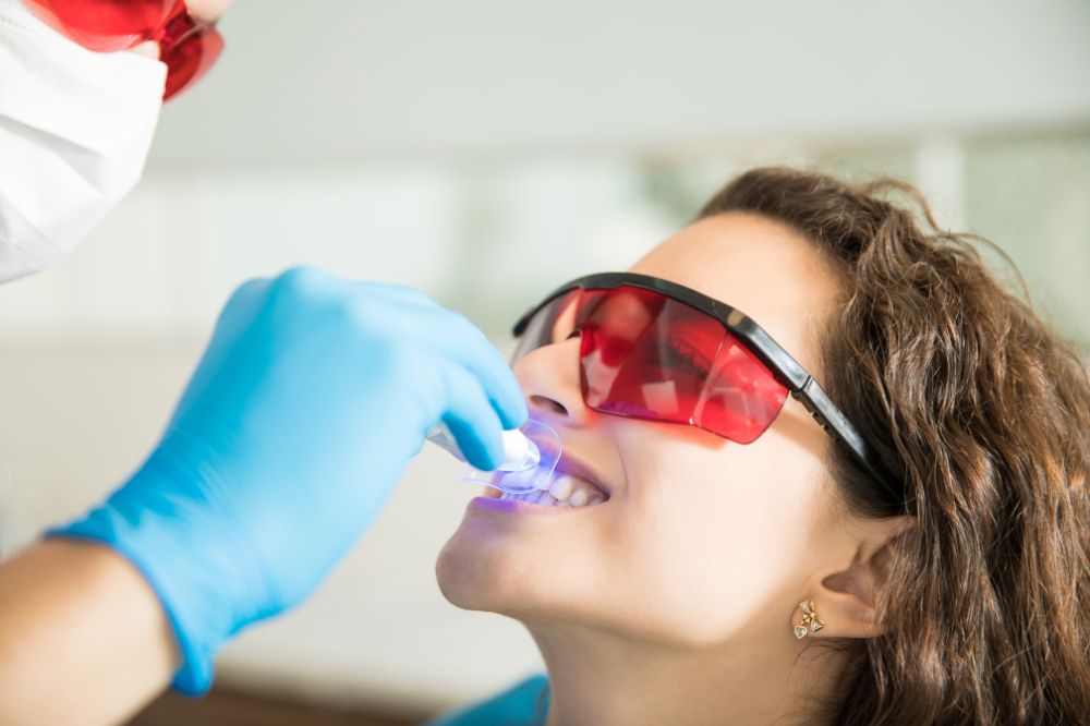 discover the secrets behind effective dental bonding for a perfect smile